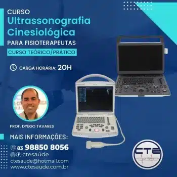 curso-ultrassonografia-cinesiologica-para-fisioterapeuta-